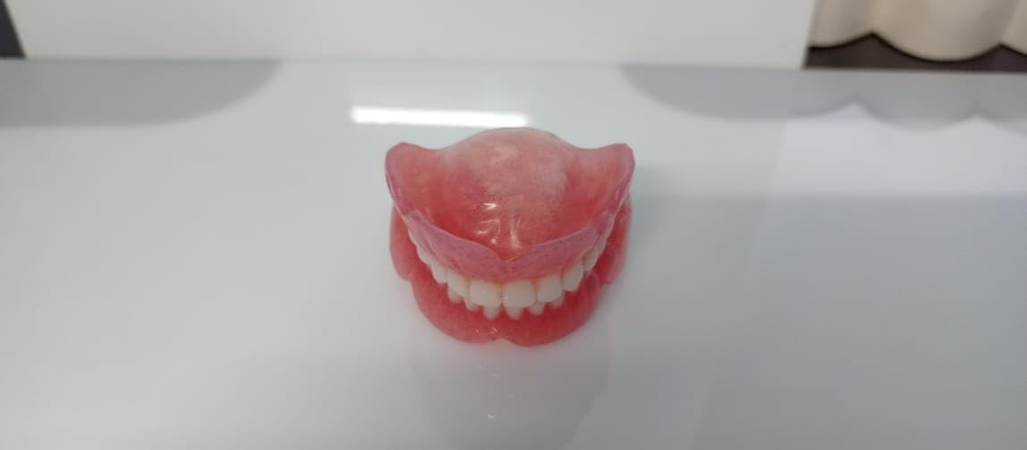 Full Set Upper & Lower Denture Q552