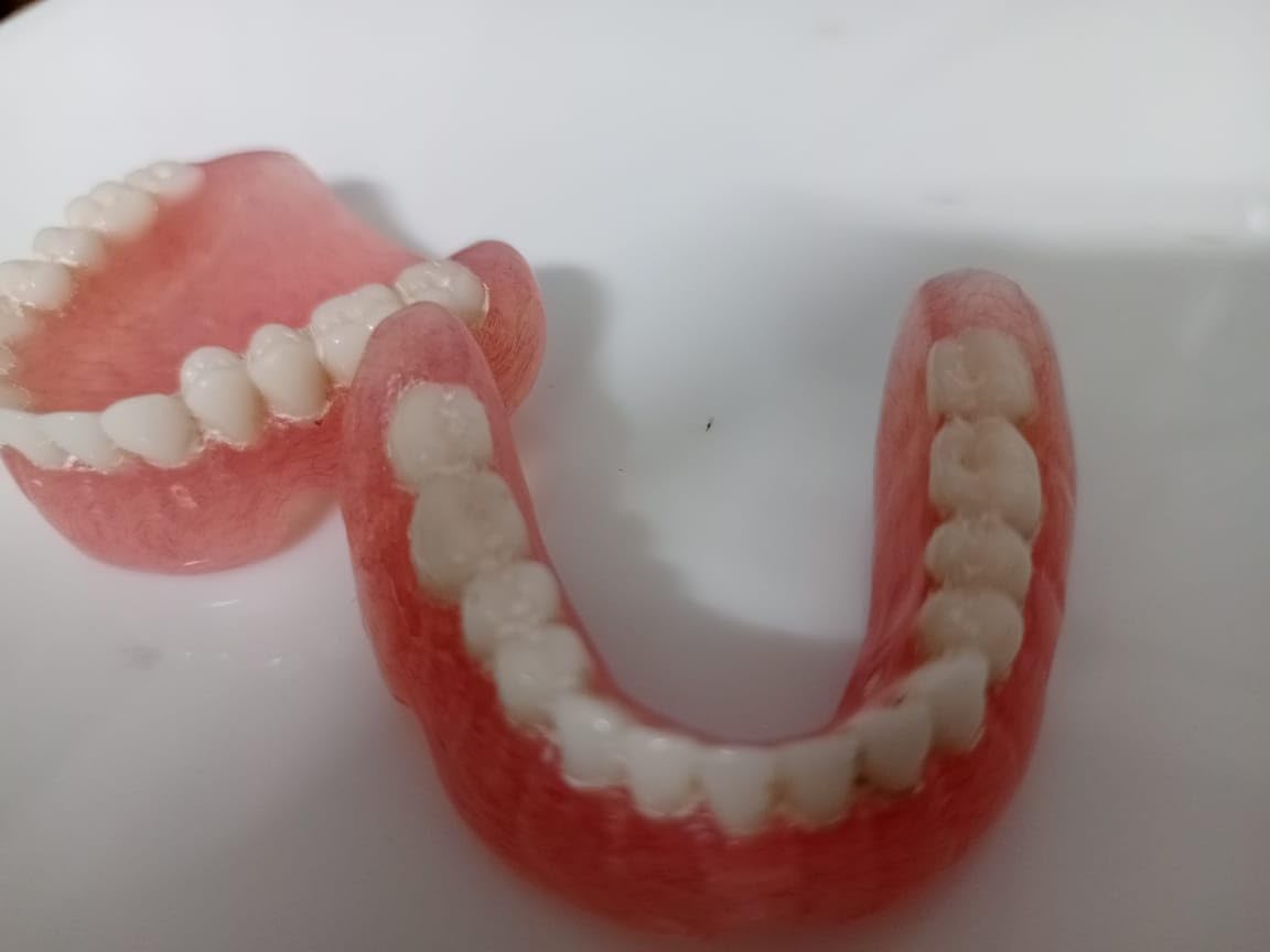 Full Set Upper & Lower Denture Q552